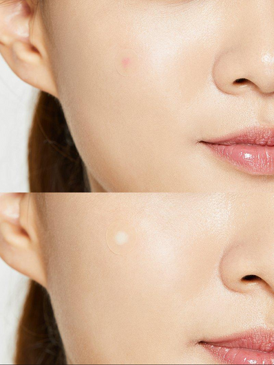 Cosrx - Acne Pimple Master Patch
