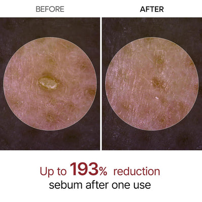 Dr. Melaxin - Peel Shot Exfoliant White Rice Ampoule