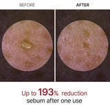 Dr. Melaxin - Peel Shot Exfoliant White Rice Ampoule