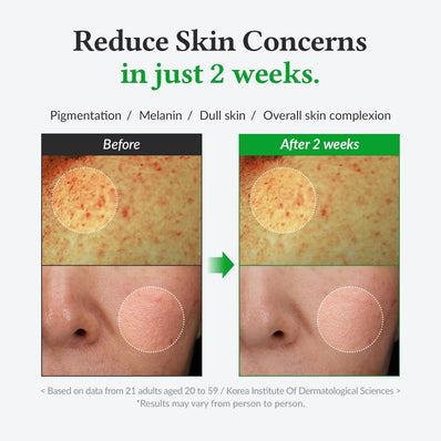 Dr. Althea - Gentle Vitamin C Serum