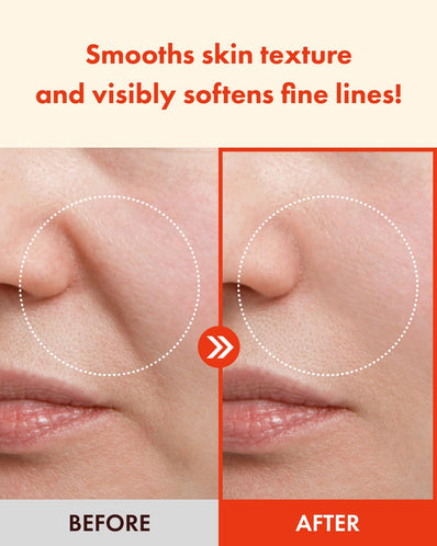 It’s Skin - Retinoidin Serum