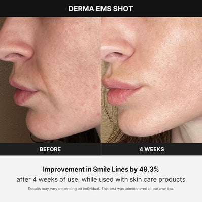 Medicube - Age-R Derma Ems Shot