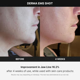 Medicube - Age-R Derma Ems Shot