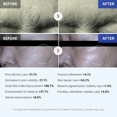 Medicube - One Day Exosome Shot 2000 – Ορός με εξωσώματα και τεχνολογία microneedle