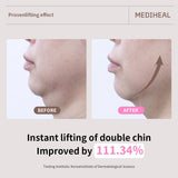 Mediheal - Retinol Collagen Ampoule Lifting Mask