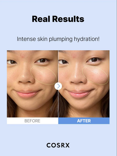 Cosrx - The Hyaluronic Acid 3 Serum