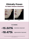 Cosrx - The Niacinamide 15 Serum