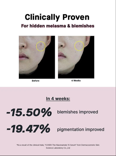 Cosrx - The Niacinamide 15 Serum