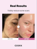 Cosrx - The Niacinamide 15 Serum