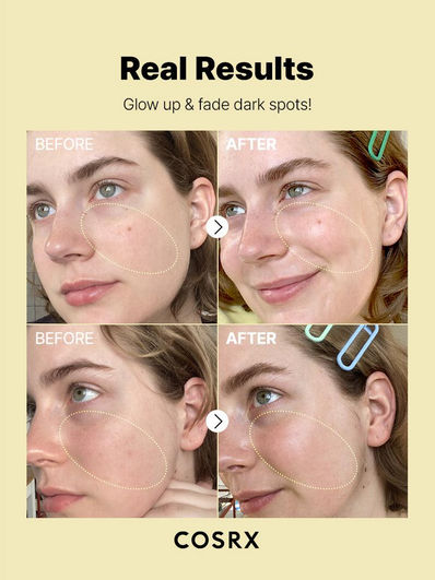 Cosrx - The Vitamin C 23 Serum