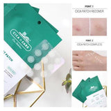 VT Cosmetics - Spot patches