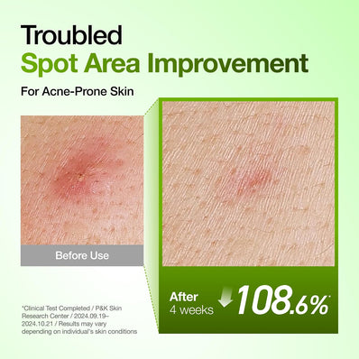 Anua - Azelaic Acid 10 Hyaluron Redness Soothing Serum