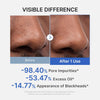 Medicube - Zero Pore Blackhead Mud Mask