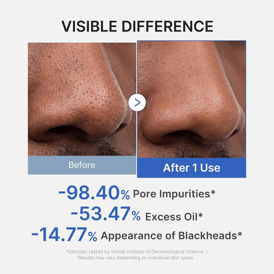 Medicube - Zero Pore Blackhead Mud Mask